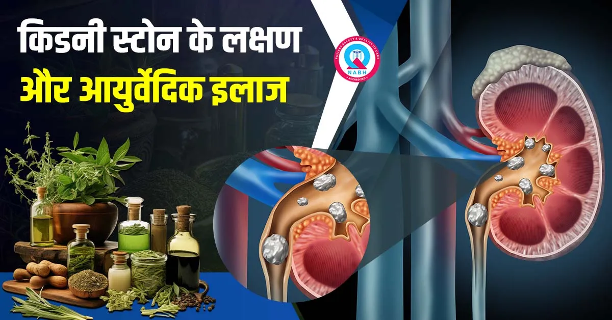 किडनी-स्टोन-के-लक्षण-और-आयुर्वेदिक-इलाज